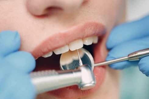 מהם הסיבוכים של השתלות שיניים